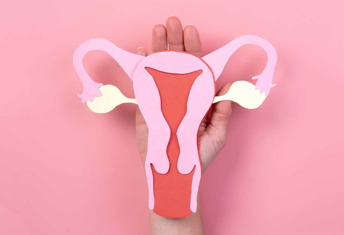 istmocele-uterina